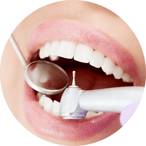 Баннер Лечение кариеса Баннер Лечение кариеса